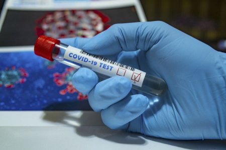 Azərbaycanda daha 367 nəfər koronavirusa yoluxub, 3 nəfər vəfat edib