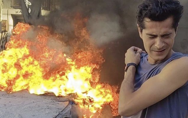 Çəkiliş meydançasında partlayış oldu - Aktyor yaralandı
