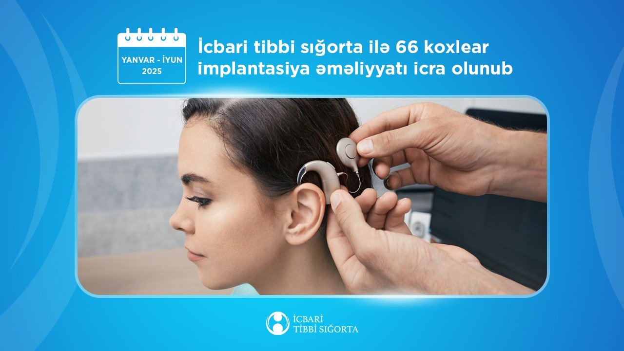 Koxlear implantasiya əməliyyatı zamanı implant və nitq prosessorunun xərclərini icbari tibbi sığorta qarşılayır