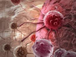 Xərçəng müalicəsi üçün edilən transplantasiya xəstəni HIV-dən də azad edib-Maraqlı araşdırma