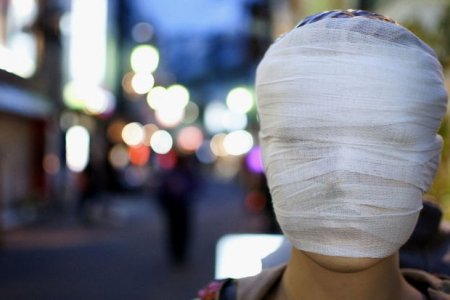 Канадцы создали гидрогелевую маску для заживления ожогов - ФОТО/ВИДЕО