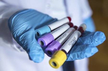 Azərbaycanda daha 6 nəfər koronavirusdan öldü – 352 YENİ YOLUXMA VAR