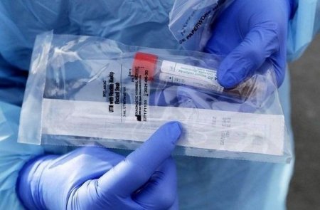 Bakıda xəstəxanada 33 tibb işçisi koronavirusa yoluxdu - ÖZƏL