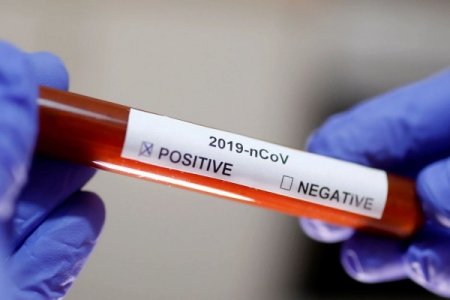 161 koronavirus xəstəsi reanimasiyadadır - RƏSMİ