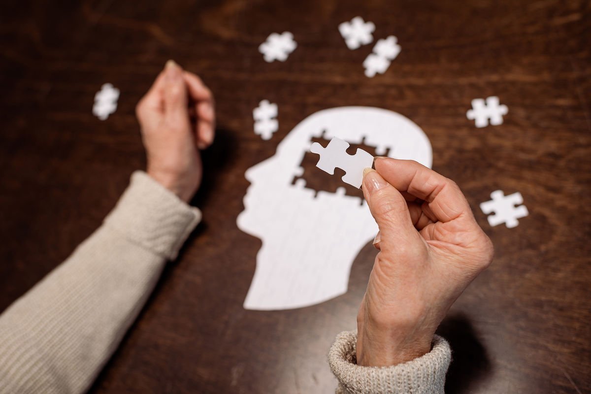 Alimlər Alzheimer xəstəliyinin yeni mümkün səbəbini tapıblar və müalicə üsulunu təklif ediblər