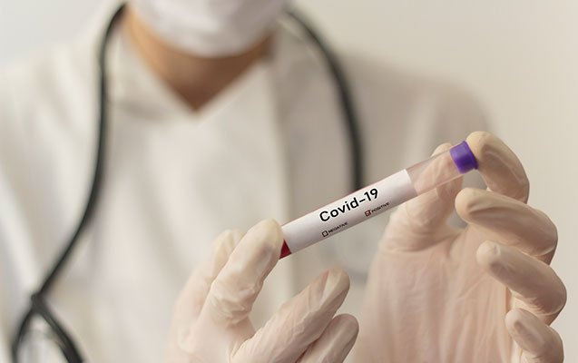 COVID-19-un pandemiya statusu ləğv edildi
