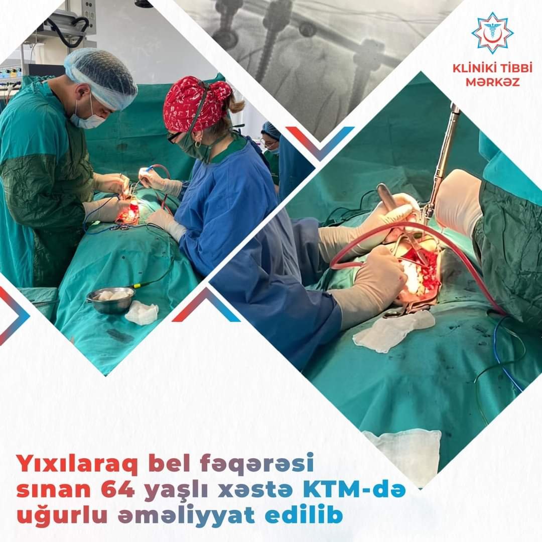 Yıxılaraq bel fəqərəsi sınan 64 yaşlı xəstə KTM-də uğurlu əməliyyat edilib