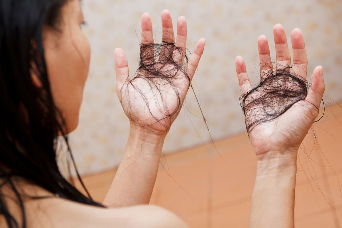 Trixoloq saç tökülməsinin əsas səbəblərini sadaladı