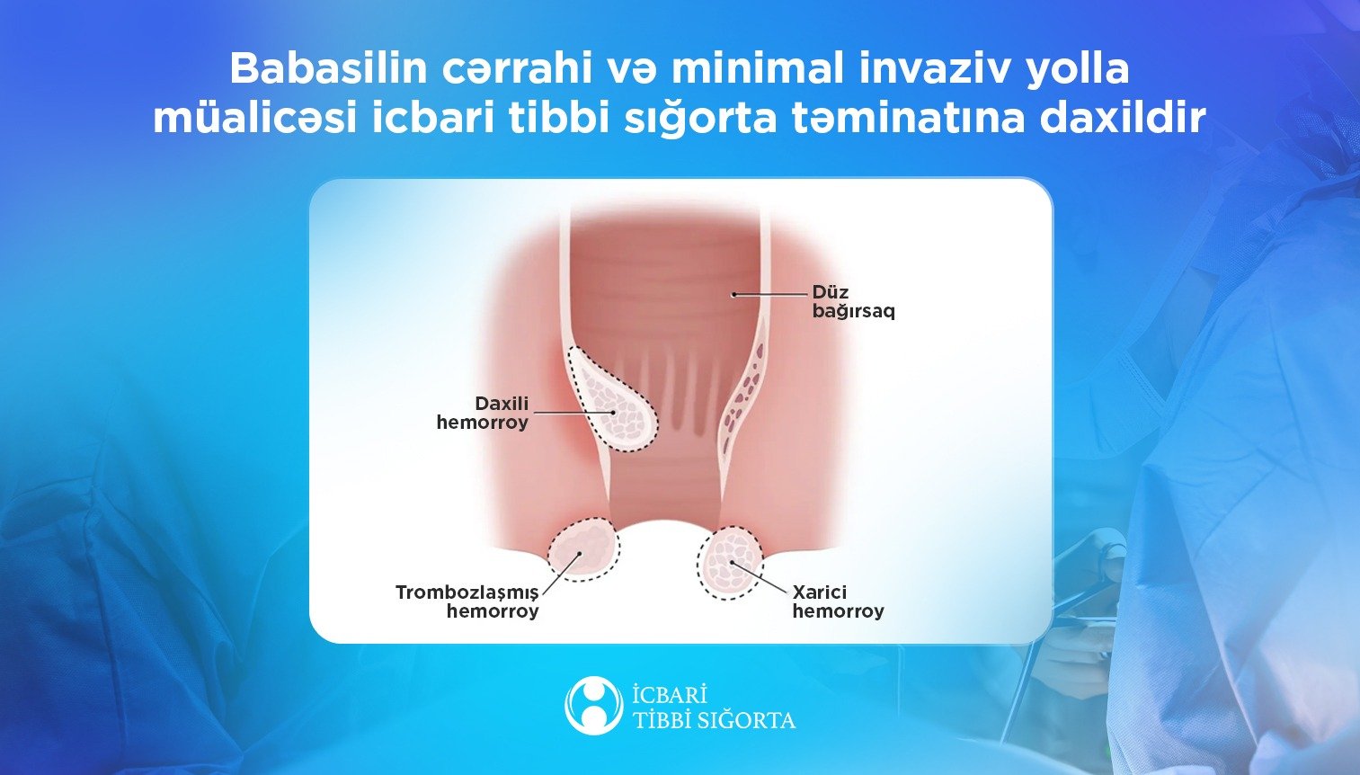 İcbari tibbi sığorta ilə babasilin müalicəsi 6 metodla qarşılanır