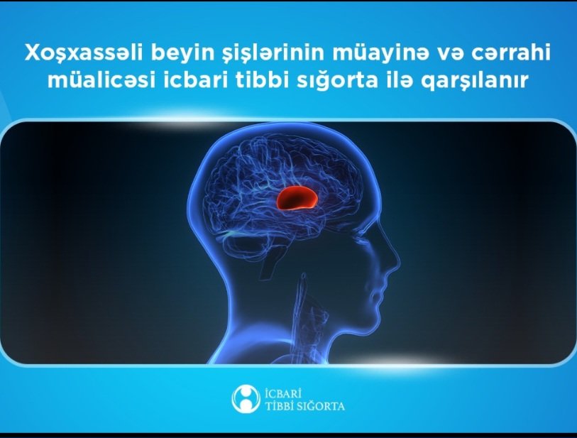 Xoşxassəli beyin şişlərinin müayinə və cərrahi müalicəsi   icbari tibbi sığorta ilə qarşılanır