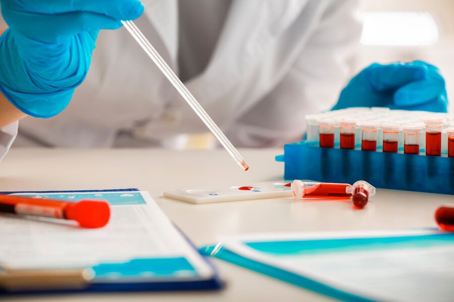 Çində bir damla qanla infeksiyalara qarşı toxunulmazlığı qiymətləndirmək üçün ekspress test hazırlayıblar