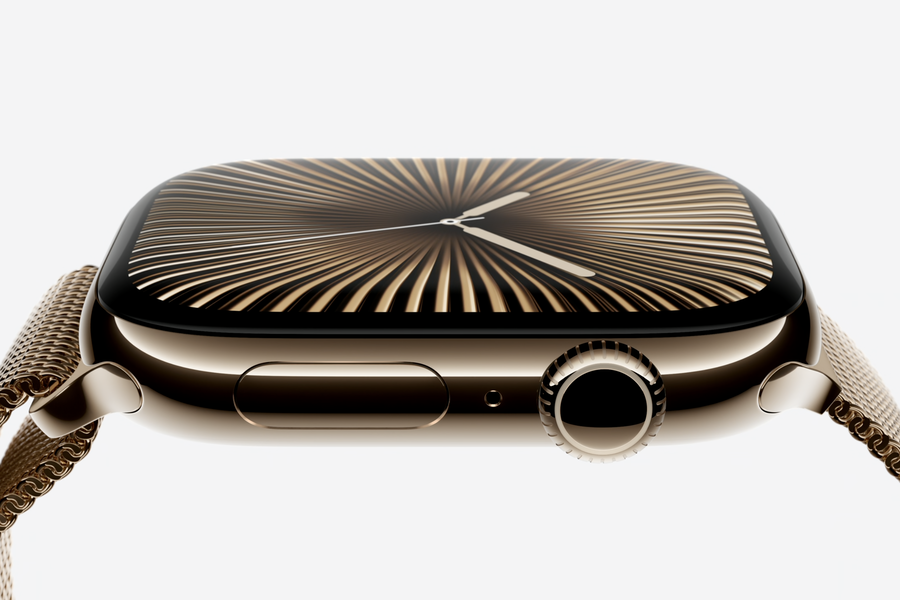 Apple Watch amerikalıya beyin şişləri barədə xəbərdarlıq edib