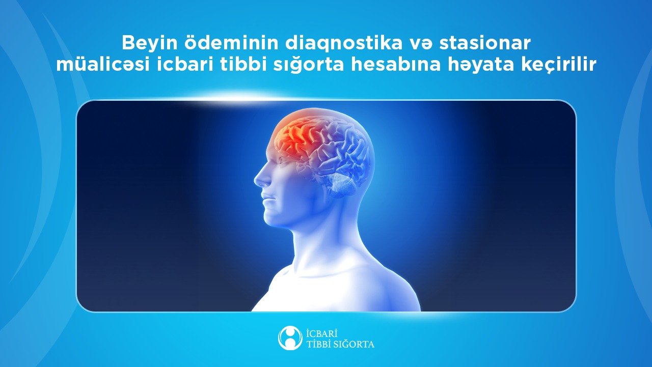 Həyati təhlükə yaradan beyin ödeminin diaqnostika və stasionar müalicəsi icbari tibbi sığorta hesabına həyata keçirilir