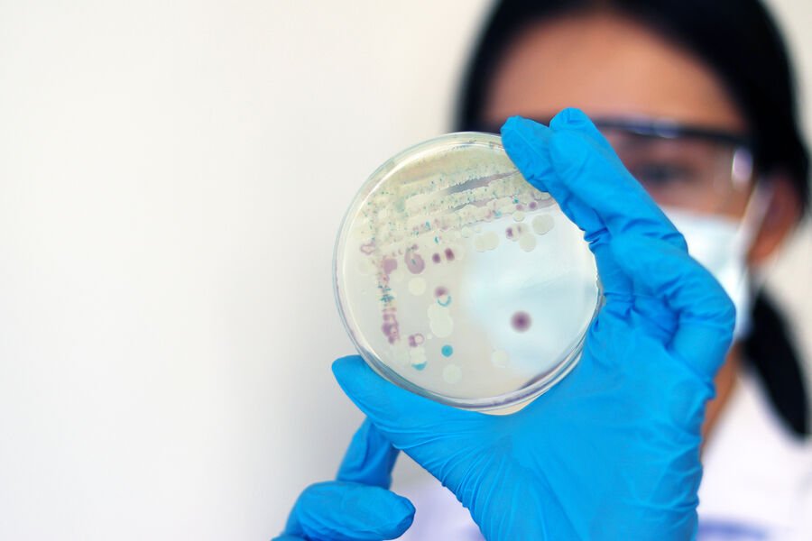 Şotlandiyada 407 milyon illik qədim göbələk tapılıb