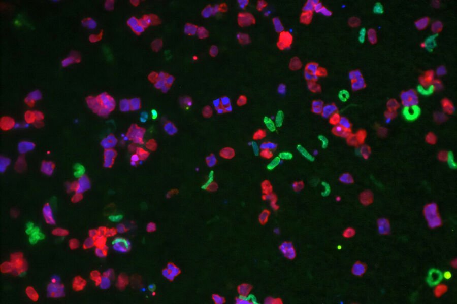 Alimlər mikroorqanizmlərin “mikrob şəhərləri”ni kosmosda öyrənməyi təklif edirlər