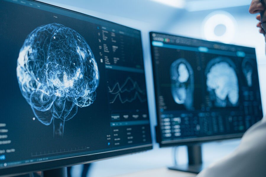 Gizli yağ yataqları beyin qocalması ilə əlaqələndirilib