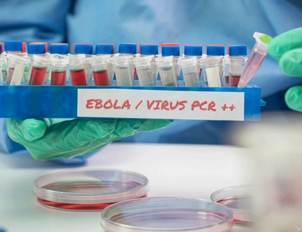 Nigeriyada Ebola virusuna ilk yoluxma halı təsdiqlənib